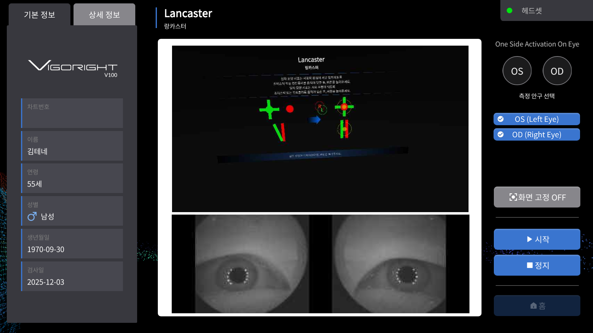 랑카스터검사
VIGORIGHT OPTIC 101